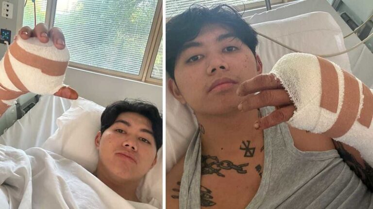 Filipino International Student in Sydney Shares How a Tiny Cut Almost Cost Him His Life